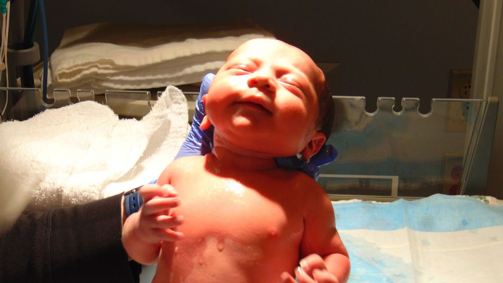 childbirth (HypnoBirth)